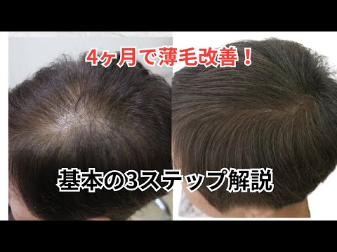 【女性の薄毛を改善する方法】基本の3ステップ/品川区中延Pensiero【ペンシエロ】